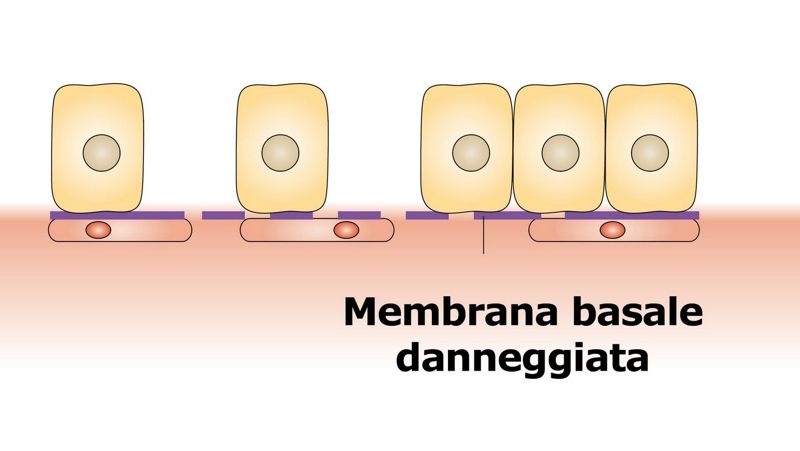 Membrana Basale